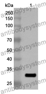 Anti-ACSL5 Polyclonal Antibody