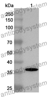 Anti-BHMT Polyclonal Antibody