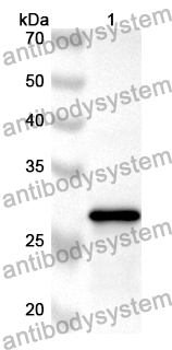 Anti-CPZ Polyclonal Antibody