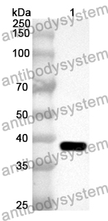 Anti-AASDHPPT Polyclonal Antibody