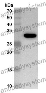 Anti-AP1M1 Polyclonal Antibody