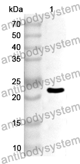 Anti-FMO2 Polyclonal Antibody