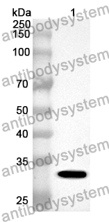 Anti-SLC17A5 Polyclonal Antibody