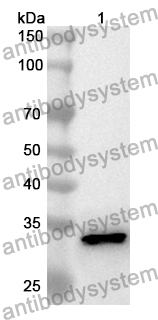 Anti-Human AMACR Polyclonal Antibody