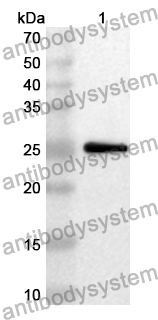 Anti-CNDP2 Polyclonal Antibody