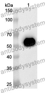 Anti-CNDP2 Polyclonal Antibody