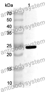 Anti-DPP8 Polyclonal Antibody