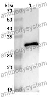 Anti-EARS2 Polyclonal Antibody