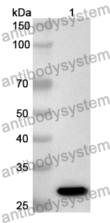 Anti-ABCG4 Polyclonal Antibody