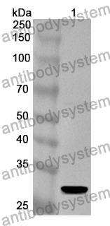 Anti-BAG5 Polyclonal Antibody