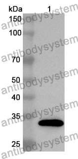 Anti-Human PLVAP Polyclonal Antibody