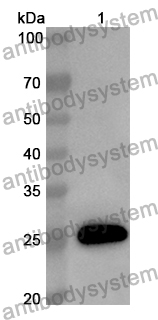 Anti-BCL11A Polyclonal Antibody