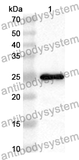 Anti-ARL15 Polyclonal Antibody