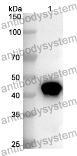 Anti-BHMT2 Polyclonal Antibody