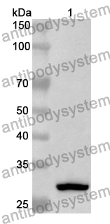 Anti-ADD3 Polyclonal Antibody