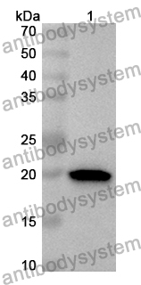 Anti-Human GPIHBP1 Polyclonal Antibody