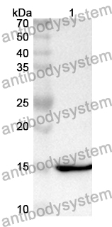 Anti-Human B3GNT3 Polyclonal Antibody