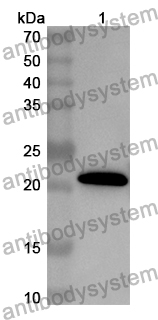 Anti-CHKB Polyclonal Antibody