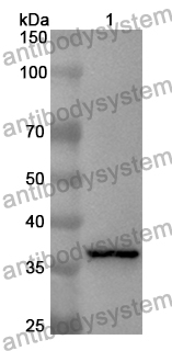 Anti-Human TNS1 Polyclonal Antibody