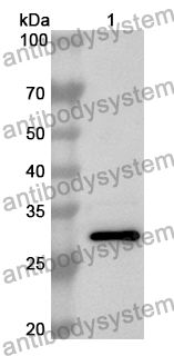 Anti-TNS3 Polyclonal Antibody