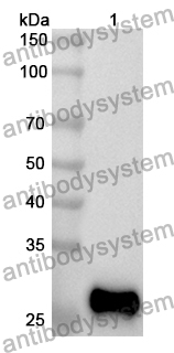 Anti-BCOR Polyclonal Antibody