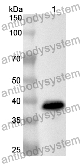 Anti-DNM3 Polyclonal Antibody