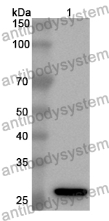 Anti-Human KLK4 Polyclonal Antibody