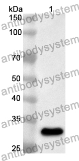 Anti-TWNK Polyclonal Antibody