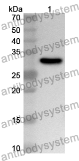 Anti-COQ10B Polyclonal Antibody