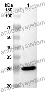 Anti-BCO1 Polyclonal Antibody