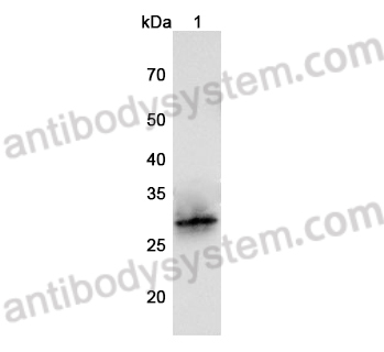 Anti-Human SFTPA1 Polyclonal Antibody