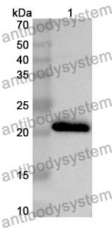 Anti-CPT1B Polyclonal Antibody