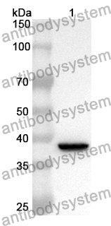 Anti-Human ATP5IF1 Polyclonal Antibody