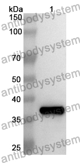 Anti-Human SERPINA12 Polyclonal Antibody