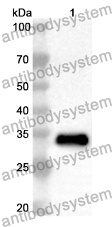 Anti-Human SLC22A12 Polyclonal Antibody