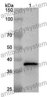 Anti-Human FETUB Polyclonal Antibody