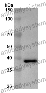 Anti-Human PLCZ1 Polyclonal Antibody