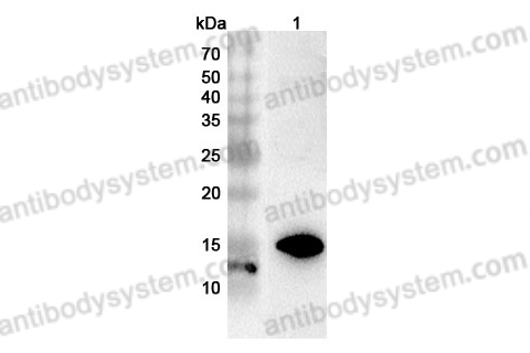 Anti-EMC6/TMEM93 Polyclonal Antibody