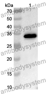 Anti-TRABD/Protein TTG2 Polyclonal Antibody