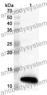 Anti-SLCO1B1/LST-1/OATP-2 Polyclonal Antibody