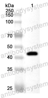 Anti-Human NEDD4L/Nedd4-2 Polyclonal Antibody