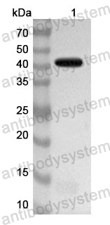 Anti-Human DOCK5 Polyclonal Antibody