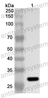 Anti-Human TRPV6/ECaC2 Polyclonal Antibody