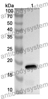 Anti-Human TRBC1 Polyclonal Antibody