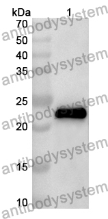 Anti-Human BCR/ABL Polyclonal Antibody