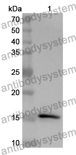 Anti-Human FOCAD Polyclonal Antibody