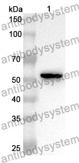 Anti-Human SMYD2 Polyclonal Antibody