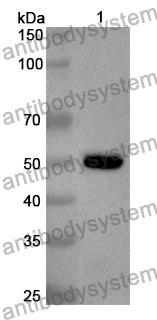 Anti-Human SMYD3 Polyclonal Antibody