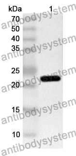 Anti-Human TDRKH Polyclonal Antibody