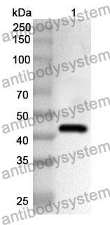 Anti-Human KDM4D Polyclonal Antibody